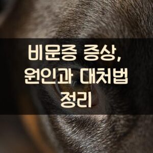 비문증 증상, 원인과 대처법 정리
