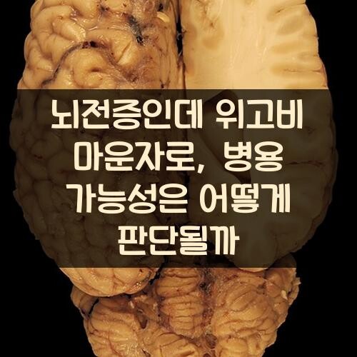 뇌전증인데 위고비 마운자로, 병용 가능성은 어떻게 판단될까?