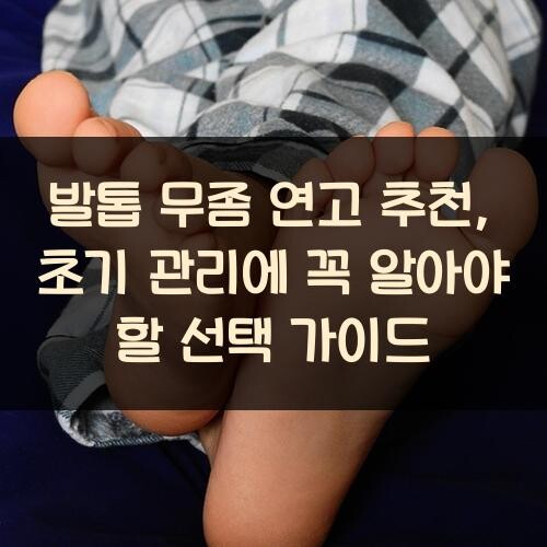 발톱 무좀 연고 추천, 초기 관리에 꼭 알아야 할 선택 가이드