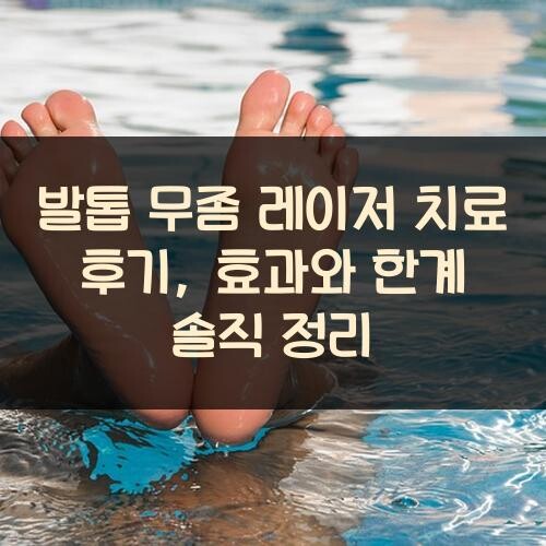 발톱 무좀 레이저 치료 후기, 효과와 한계 솔직 정리