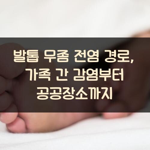 발톱 무좀 전염 경로, 가족 간 감염부터 공공장소까지
