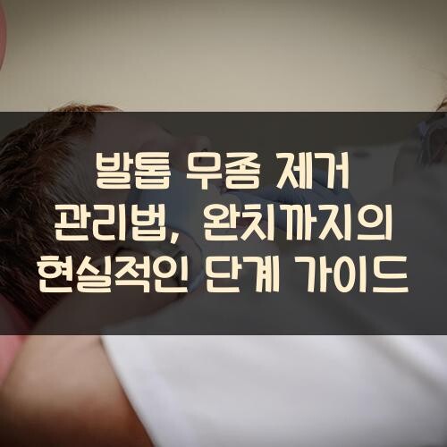 발톱 무좀 제거 관리법, 완치까지의 현실적인 단계 가이드